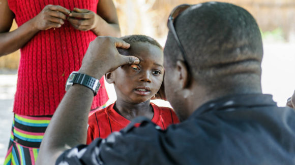En trakom-lege fra Sightsavers undersøker øynene til beboere i en landsby i et øde område.