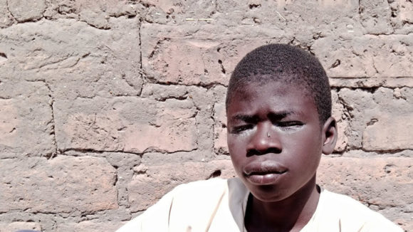 En tenåring som lider av trichiasis, sittende ved en mur.