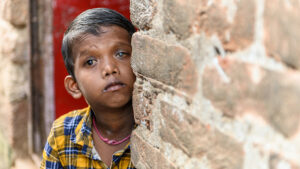 Sanjit standing partially hidden behind a wall whilst looking towards the camera. The cataracts are noticeable in his eyes.