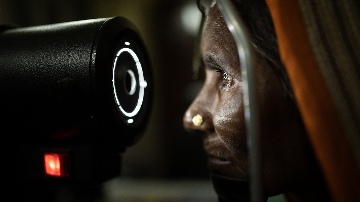 Et nærbilde av en kvinnes sideprofil mens hun stirrer inn i et medisinsk øyeinstrument.