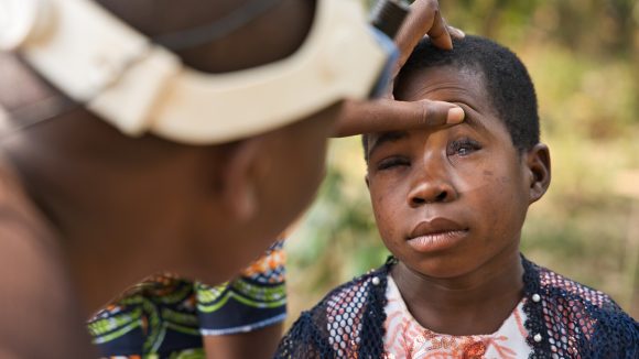 Samanthas øye blir undersøkt av en helsearbeider.