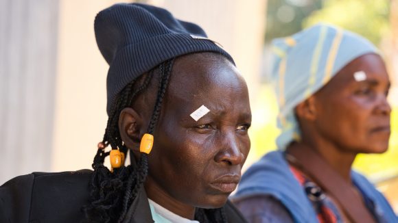 Maria fra Zimbabwe, som har et hvitt klistremerke over høyre øye, ser alvorlig ut mens hun stirrer ut i det fjerne.